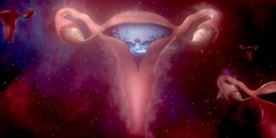 bodyform